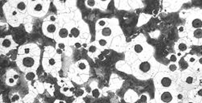 Microstructure of ductile iron